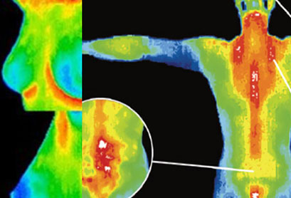 Example thermal image of the upper body.