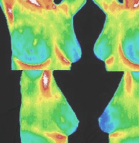 Example thermography images showing surface temperature patterns.